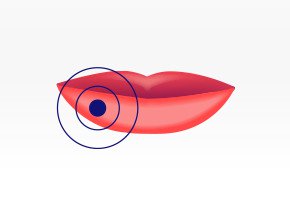 Cold Sores The 5 Stages Of A Cold Sore Outbreak Orajel Cold Sores The 5 Stages Of A Cold Sore Outbreak Orajel