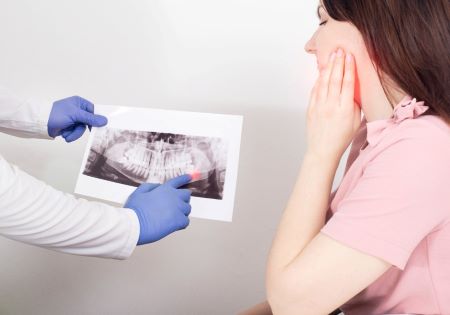 a dentist shows an x-ray of impacted wisdom teeth to a woman having wisdom tooth pain
